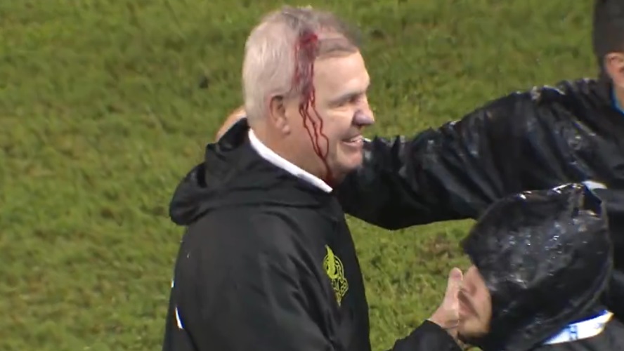 https://www.soccernews.com/wp-content/uploads/2024/11/aguirre-bloody.jpg